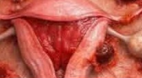 Endometriosis: What Every Woman Should Know – Symptoms, Causes, and Gentle Ways to Care for Yourself 💛