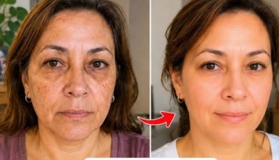 Baking Soda for Skin: Benefits, Risks & How to Use It Safely on Your Face