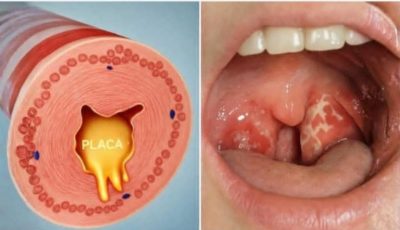 Cleanse your airways in just 2 days with this ancient sage leaf remedy