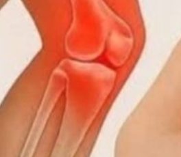 The vitamin the body lacks when legs and bones are painful