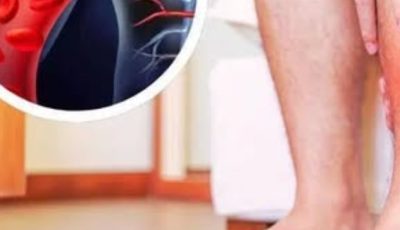 One vitamin that opens blood vessels and improves circulation
