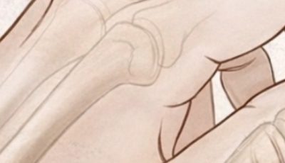 Why Do Your Hands Fall Asleep? Common Causes and Natural Remedies That Actually Work