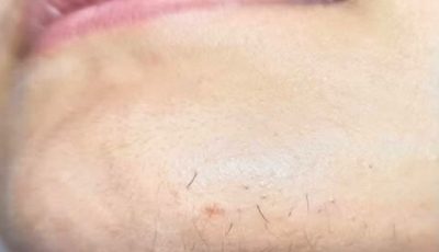A Woman’s Chin Hair Could Be a Sign of More Than Just Aging, Experts Say